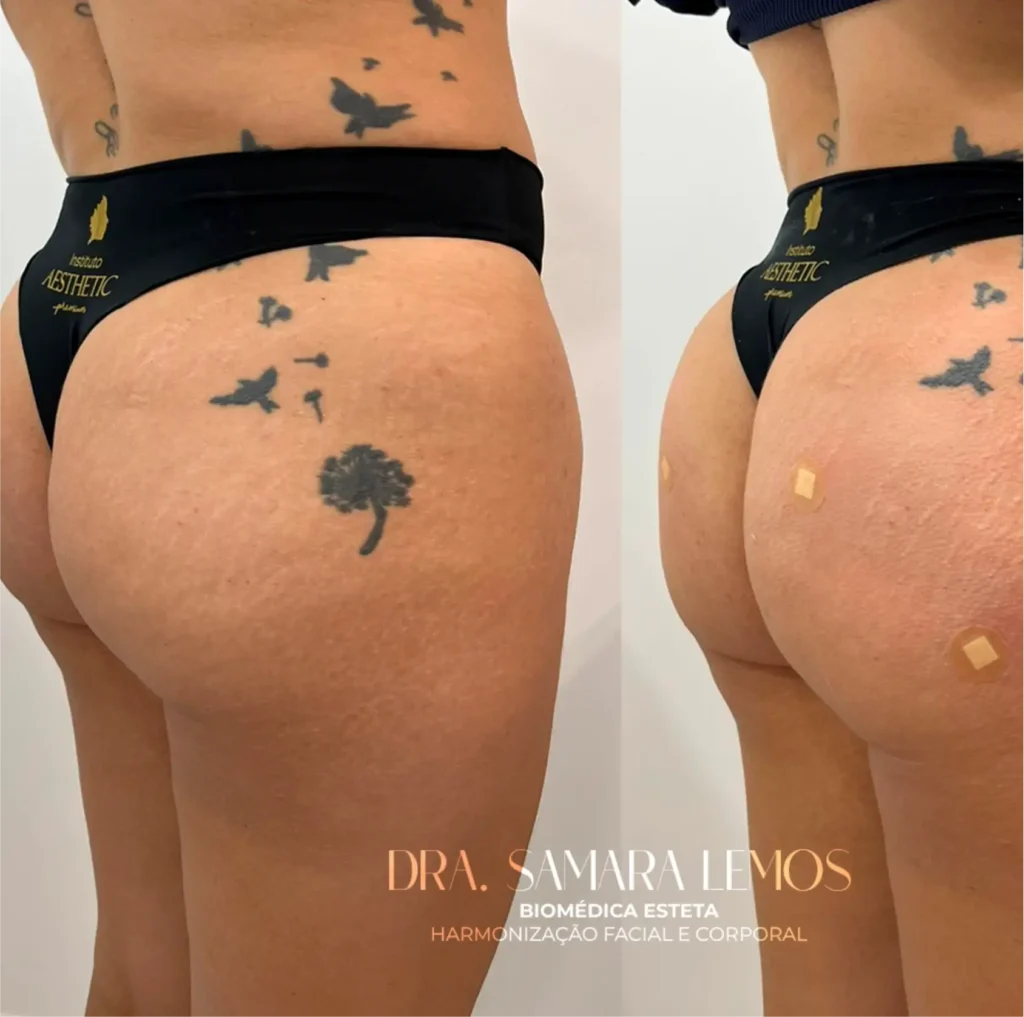 Antes e depois 9