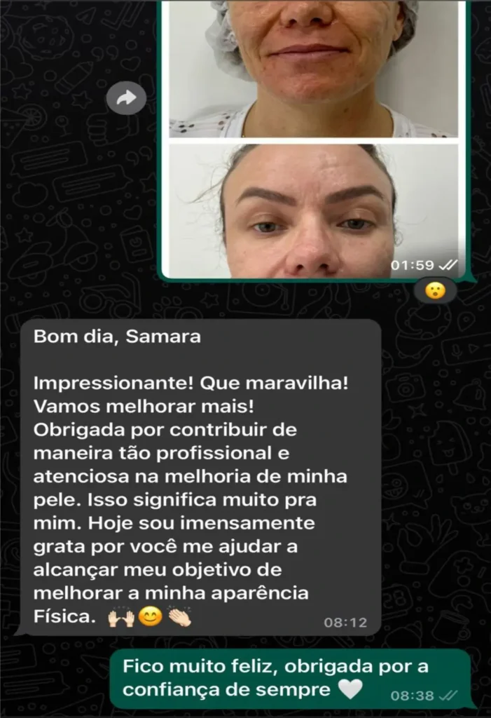 Dra. Samara depoimento 3